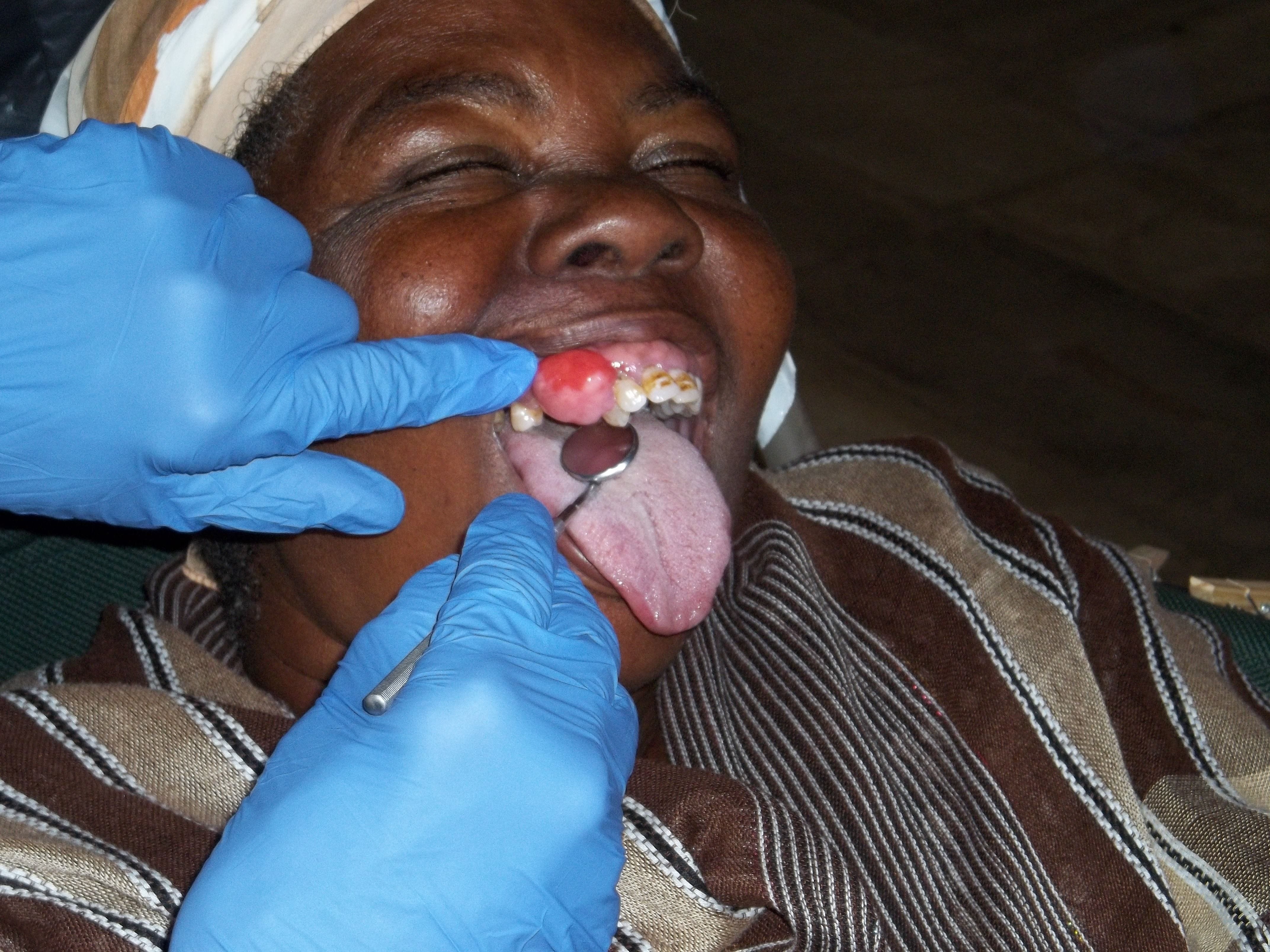 Woman Receiving Dental Care